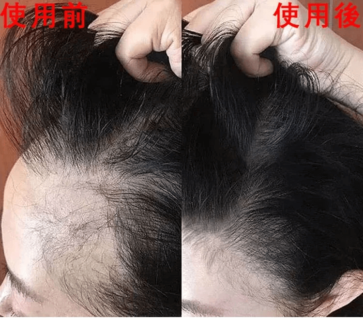 育草堂草本防脫育髮洗髮露