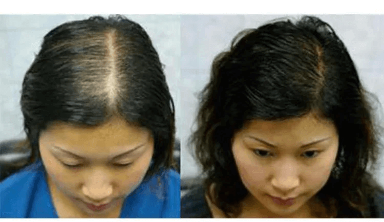 育草堂草本防脫育髮洗髮露