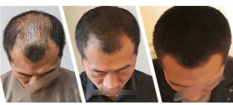 育草堂草本防脫育髮洗髮露