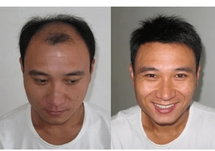 育草堂草本防脫育髮洗髮露